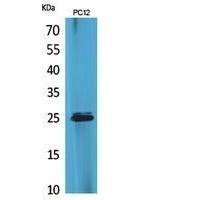 CMTM5 Polyclonal Antibody