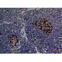 CMTM5 Polyclonal Antibody