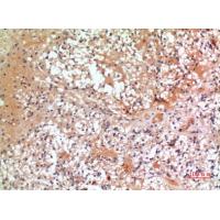 CMTM6 Polyclonal Antibody