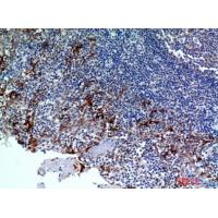 CMTM8 Polyclonal Antibody