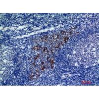 CMTM8 Polyclonal Antibody