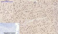 c-Myc Polyclonal Antibody