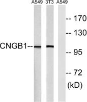 CNG-1β Polyclonal Antibody