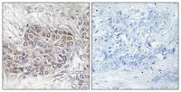 CNK1 Polyclonal Antibody
