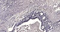 LRP3 Polyclonal Antibody