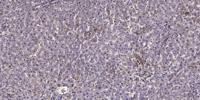 LRP2 Polyclonal Antibody