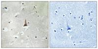 LRP10 Polyclonal Antibody