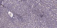 LRP1 Polyclonal Antibody