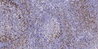LRBA Polyclonal Antibody