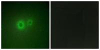 LRAT Polyclonal Antibody