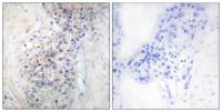 LRAT Polyclonal Antibody
