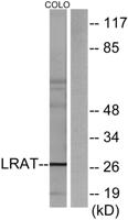 LRAT Polyclonal Antibody