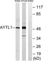 LPCAT2 Polyclonal Antibody