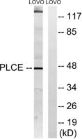 LPAAT-ε Polyclonal Antibody