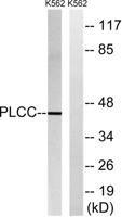 LPAAT-γ Polyclonal Antibody