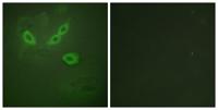 LOST1 Polyclonal Antibody