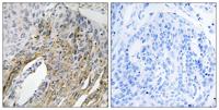 LONP2 Polyclonal Antibody