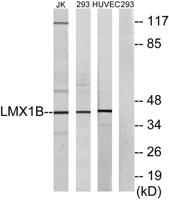 LMX1B Polyclonal Antibody