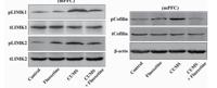 LIMK-2 Polyclonal Antibody