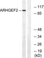 Lfc Polyclonal Antibody