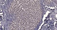 RPS6KL1 Polyclonal Antibody