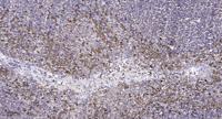 Lck Polyclonal Antibody