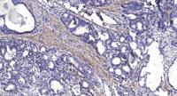 Lck BP-1 Polyclonal Antibody