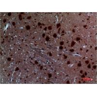 Layilin Polyclonal Antibody