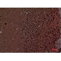 Layilin Polyclonal Antibody