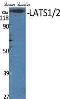 LATS1/2 Polyclonal Antibody