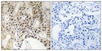 LATS1/2 Polyclonal Antibody