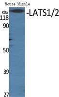 LATS1/2 Polyclonal Antibody