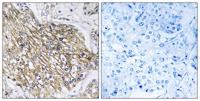 Latrophilin-2 Polyclonal Antibody