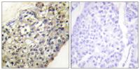 Latherin Polyclonal Antibody