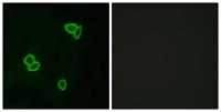 Latrophilin-1 Polyclonal Antibody