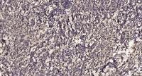 Latrophilin-1 Polyclonal Antibody