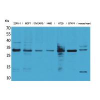 Latexin Polyclonal Antibody