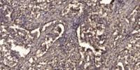 LAT Polyclonal Antibody