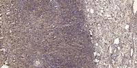 LAT Polyclonal Antibody