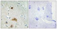 LASS4 Polyclonal Antibody