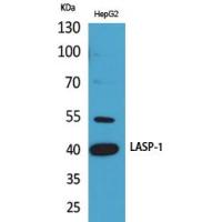 LASP-1 Polyclonal Antibody