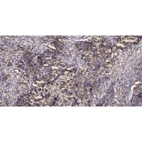 LASP-1 Polyclonal Antibody