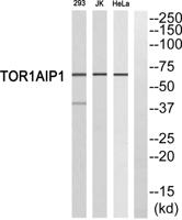 LAP1B Polyclonal Antibody