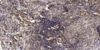 LAP1B Polyclonal Antibody
