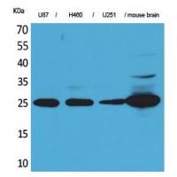 UCH-L1 Polyclonal Antibody