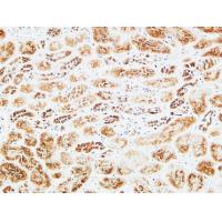 UCH-L1 Polyclonal Antibody