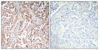 UCP2 Polyclonal Antibody