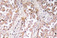 UCP2 Polyclonal Antibody