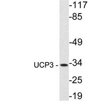 UCP3 Polyclonal Antibody