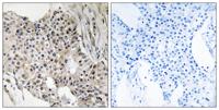 UEV3 Polyclonal Antibody